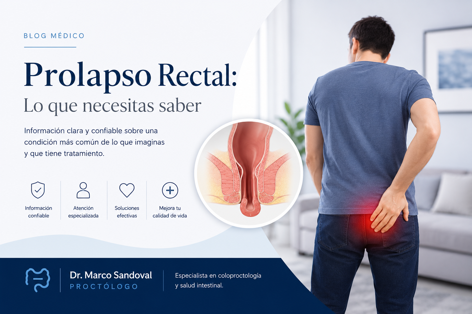 Prolapso rectal: Cómo detectarlo y cuáles son sus síntomas