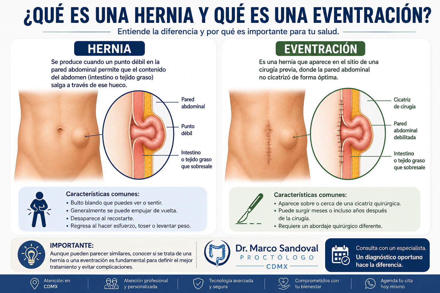 Hernia y eventración: Cómo detectarla, sus causas y síntomas — y dónde consultar en CDMX