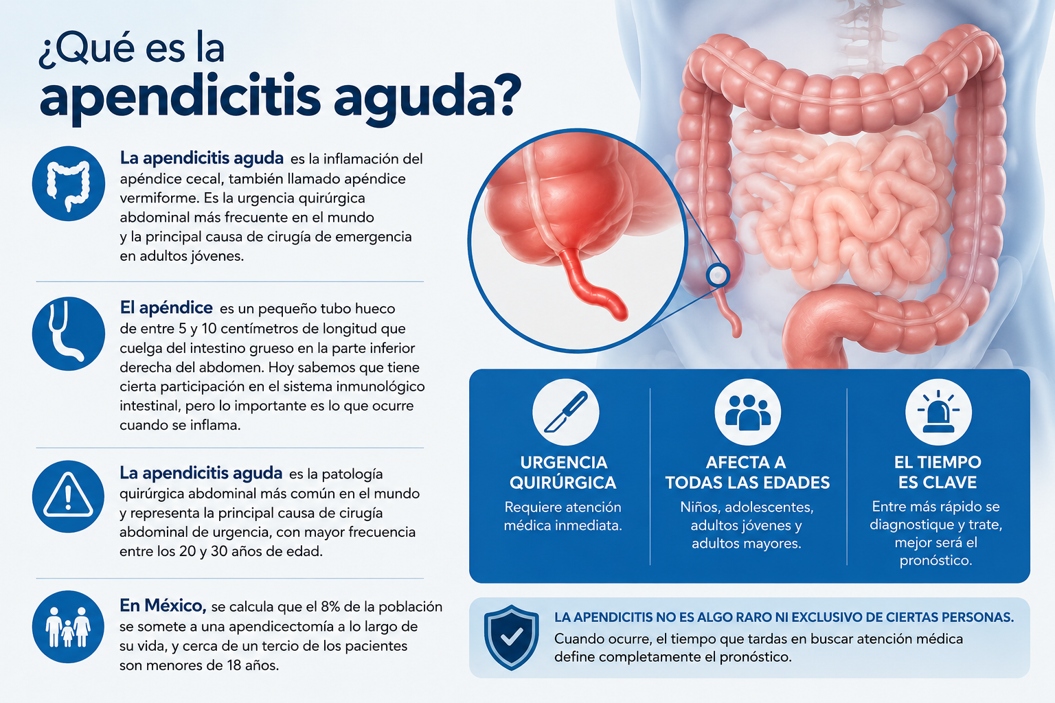 ¿Qué es la Apendicitis Aguda? Síntomas, Causas y Cuándo Ir a Urgencias